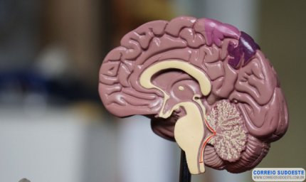 CASOS DE SÍNDROME DE GUILLAIN-BARRÉ SÃO RAROS E QUALQUER VACINA, OU MESMO INFECÇÕES, PODEM PROVOCÁ-LA