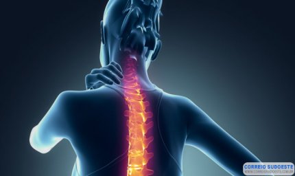 MÁ POSTURA NO TRABALHO É A PRINCIPAL CAUSA DE CERVICALGIA