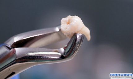 Homem morre por infecção após colocar facetas dentárias e família pede investigação