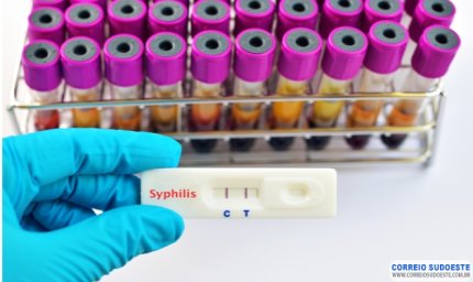 Minas está em alerta contra disparada dos casos de sífilis, com média de 63 infecções por dia
