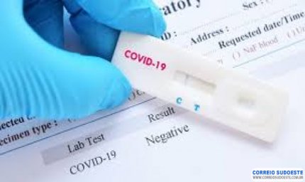 SANTA CASA RECEBERÁ R$ 30 MIL PARA AQUISIÇÃO DE TESTES EM INTERNADOS COM SUSPEITA DE INFECÇÃO PELO NOVO CORONAVÍRUS