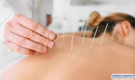 Projeto determina oferecimento de acupuntura e homeopatia no SUS