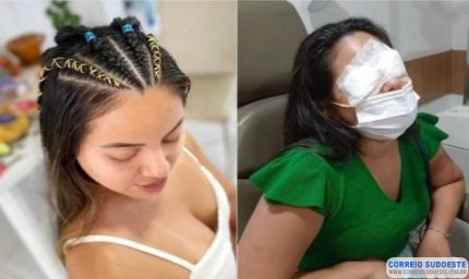 Anvisa proíbe venda de todas as pomadas modeladoras de tranças de cabelo