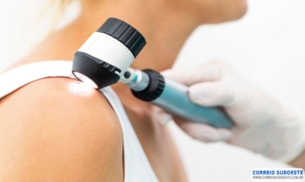 Dezembro Laranja: câncer de pele não melanoma é o mais prevalente na população brasileira