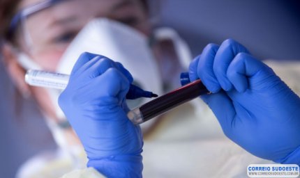 Teste Covid: PCR ou antígeno, qual é o mais indicado para o seu caso?